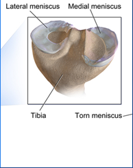 sports medicine video